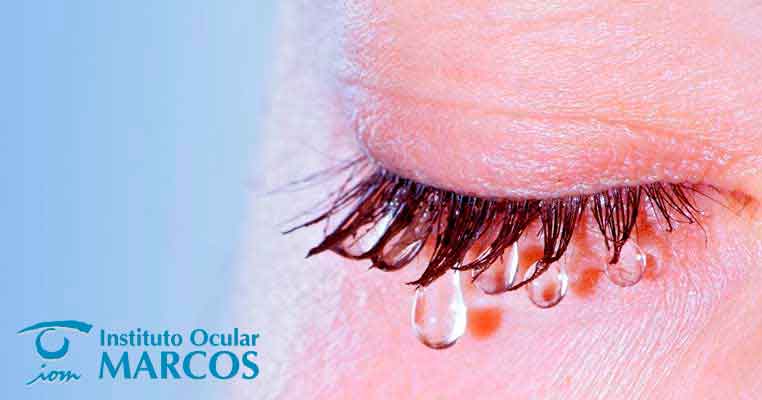 Cirugía oculoplástica